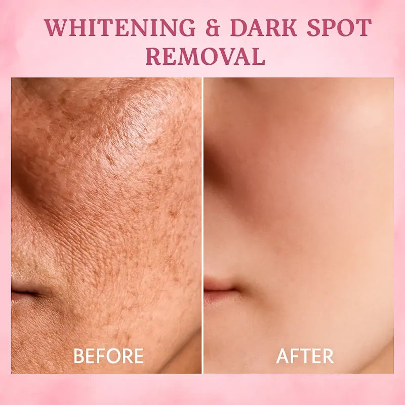 🔥𝐋𝐚𝐬𝐭 𝐃𝐚𝐲 𝐃𝐢𝐬𝐜𝐨𝐮𝐧𝐭: 𝟕5% 𝐎𝐅𝐅 - LUXYRAIN® 7-Day Body Reset: The All-in-One Firming & Brightening Cream